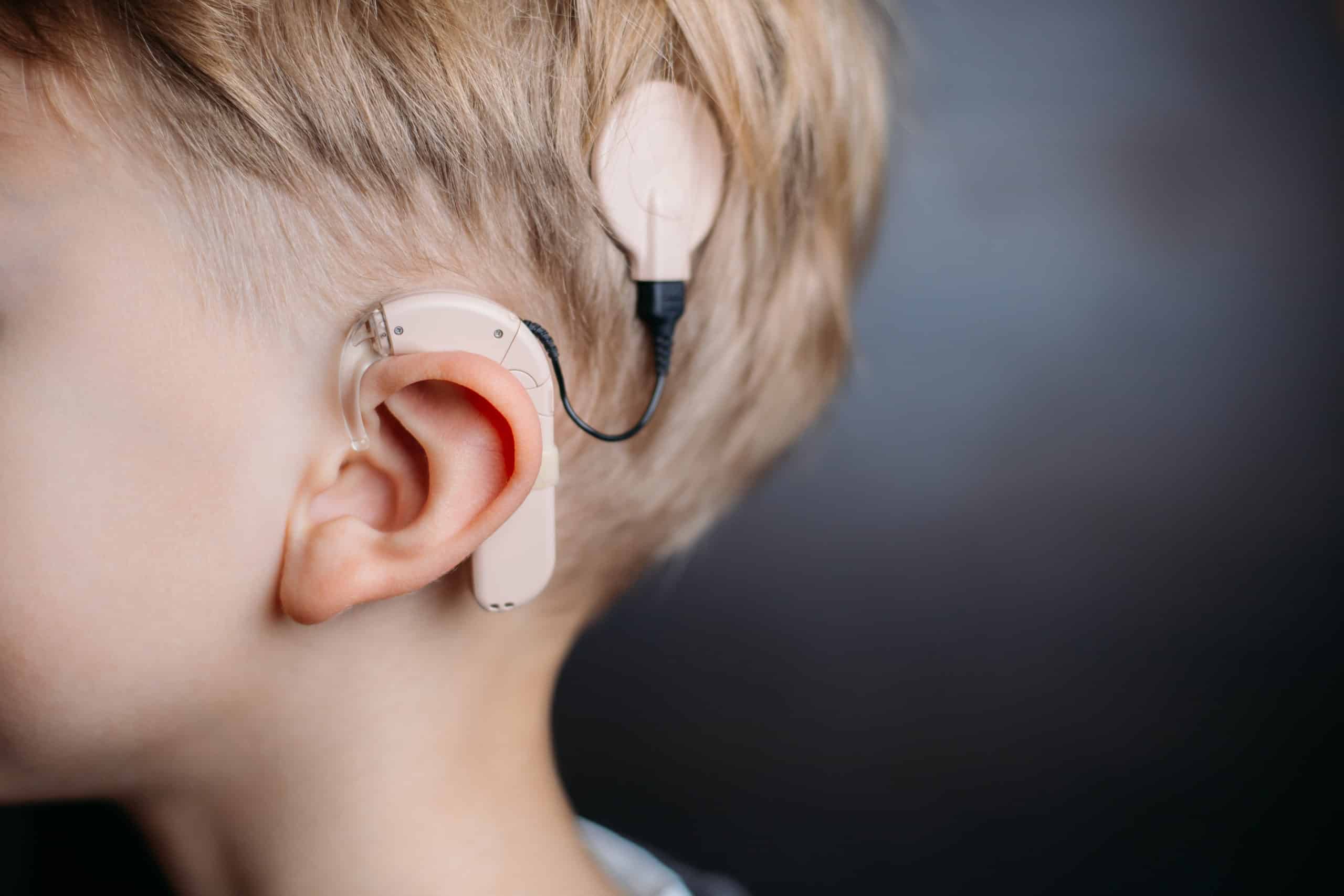 Child wearing a cochlear implant sound processor